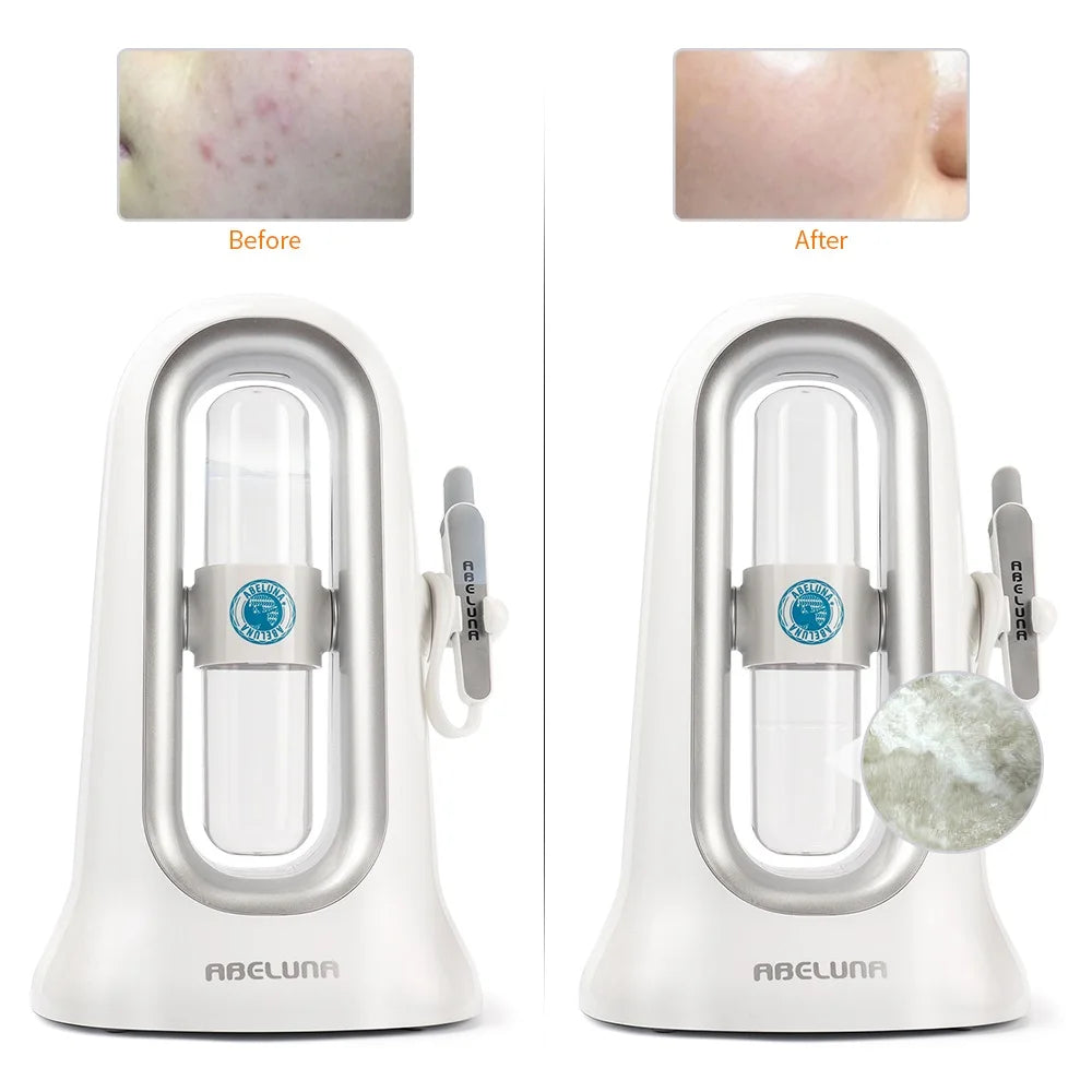 Hydra Dermabrasion Facial Machine